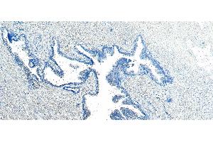 (ABIN185182) Negative Control showing staining of paraffin embedded Human Prostate, with no primary antibody.