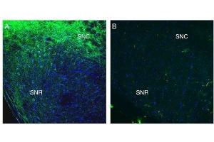 Expression of SLC41A2 in mouse midbrain. (SLC41A2 antibody  (Extracellular, N-Term))