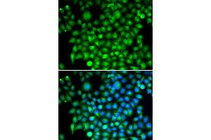Immunofluorescence analysis of HeLa cells using CFI antibody (ABIN5973275). (Complement Factor I antibody)