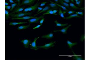 Immunofluorescence of purified MaxPab antibody to CAPN10 on HeLa cell. (CAPN10 antibody  (AA 1-672))