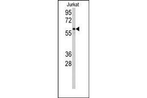 Image no. 1 for anti-Cytochrome P450, Family 2, Subfamily C, Polypeptide 9 (CYP2C9) (N-Term) antibody (ABIN360238) (CYP2C9 antibody  (N-Term))