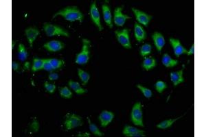 Immunofluorescence staining of A549 cells with ABIN7173972 at 1:133, counter-stained with DAPI. (DIO2 antibody  (AA 74-222))