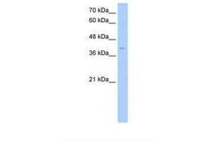 Image no. 1 for anti-Zinc Finger, DHHC-Type Containing 17 (ZDHHC17) (AA 311-360) antibody (ABIN341627) (ZDHHC17 antibody  (AA 311-360))