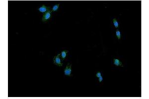 IF analysis of DRP1/DNM1L using anti-DRP1/DNM1L antibody (ABIN7602180).