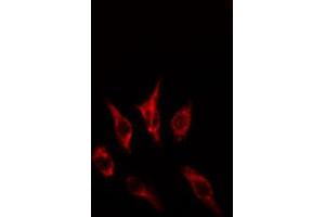 ABIN6274613 staining HepG2 cells by IF/ICC.