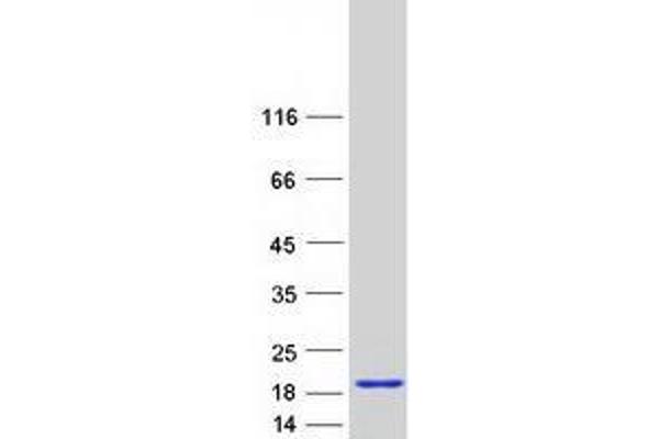 ZNF593 Protein (Myc-DYKDDDDK Tag)