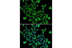 Immunofluorescence analysis of MCF-7 cells using ASPA antibody (ABIN6127373, ABIN6137211, ABIN6137212 and ABIN6223094). (ASPA antibody  (AA 1-313))