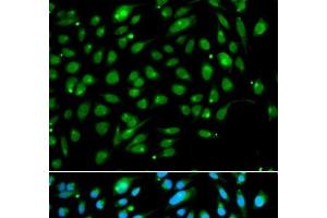 Immunofluorescence analysis of A549 cells using ING3 Polyclonal Antibody (ING3 antibody)