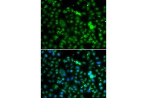 Immunofluorescence analysis of MCF-7 cells using NSUN6 antibody (ABIN6132426, ABIN6144879, ABIN6144881 and ABIN6217457). (NSUN6 antibody  (AA 220-469))