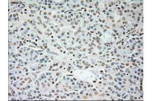Immunohistochemistry (IHC) image for anti-Cardiac Troponin I (TNNI3) (AA 1-210) antibody (ABIN1490609) (TNNI3 antibody  (AA 1-210))