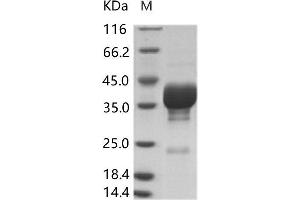 Western Blotting (WB) image for Coxsackie Virus A16 VP4 (Cox A16 VP4) protein (Fc Tag) (ABIN7198888)