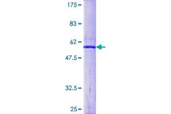 CDC34 Protein (AA 1-236) (GST tag)