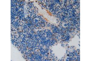 Used in DAB staining on fromalin fixed paraffin- embedded spleen tissue (PAI1 antibody  (AA 141-389))