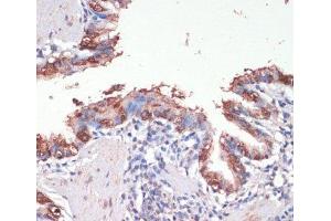 Immunohistochemistry of paraffin-embedded Rat lung using MSI1 Polyclonal Antibody at dilution of 1:200 (40x lens). (MSI1 antibody)