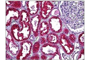 Human Kidney, Tubules: Formalin-Fixed, Paraffin-Embedded (FFPE) (CST3 antibody)