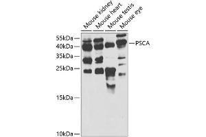 Western blot analysis of extracts of various cell lines, using PSCA antibody  at 1:1000 dilution. (PSCA antibody  (AA 12-114))