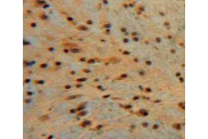 Used in DAB staining on fromalin fixed paraffin-embedded brain tissue (Midkine antibody  (AA 22-140))