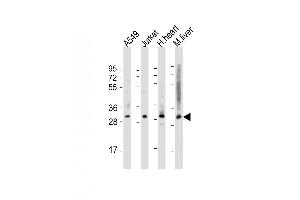 Western Blot at 1:2000 dilution Lane 1: A549 whole cell lysate Lane 2: Jurkat whole cell lysate Lane 3: human heart lysate Lane 4: mouse liver lysate Lysates/proteins at 20 ug per lane.