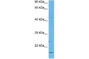 Host:  Rabbit  Target Name:  ND6  Sample Tissue:  Human Lung Tumor  Antibody Dilution:  1ug/ml (MT-ND6 antibody  (Middle Region))