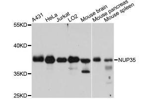 Western blot analysis of extracts of various cell lines, using NUP35 antibody. (NUP35 antibody)
