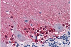 Human Brain, Cerebellum: Formalin-Fixed, Paraffin-Embedded (FFPE) (CBS antibody  (AA 1-101))