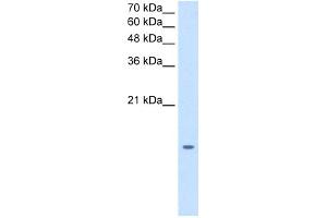 WB Suggested Anti-MGST2 Antibody Titration:  1. (MGST2 antibody  (N-Term))