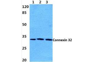 Western blot analysis of Connexin 32 (L115) Antibody at 1/500 dilution:  Lane 1: Hela cell lysate. (GJB1 antibody)