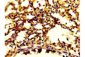 anti-S100 Calcium Binding Protein A4 (S100A4) (AA 2-101) antibody