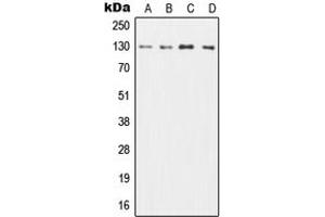 Western blot analysis of CD131 expression in HL60 (A), TF1 (B), SP2/0 (C), H9C2 (D) whole cell lysates. (CD131 antibody  (C-Term))
