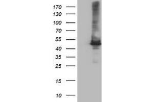 Image no. 2 for anti-Carboxypeptidase A1 (Pancreatic) (CPA1) antibody (ABIN1497591) (CPA1 antibody)