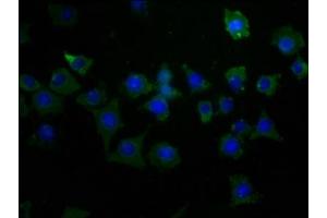 Immunofluorescence staining of SH-SY5Y cells with ABIN7163961 at 1:50, counter-stained with DAPI. (Kv2.1/KCNB1 antibody  (AA 535-765))