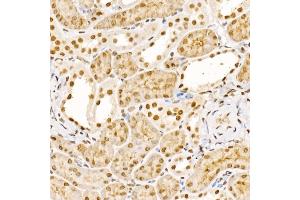 Immunohistochemistry of paraffin-embedded mouse kidney using UBB Rabbit pAb (ABIN6130181, ABIN6149775, ABIN6149776 and ABIN6222958) at dilution of 1:200 (40x lens).