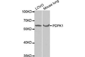Western blot analysis of extracts of various cell lines, using PDPK1 antibody. (PDPK1 antibody  (AA 150-429))