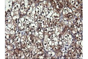 Image no. 1 for anti-butyrobetaine (Gamma), 2-Oxoglutarate Dioxygenase (Gamma-butyrobetaine Hydroxylase) 1 (BBOX1) antibody (ABIN1496819) (BBOX1 antibody)