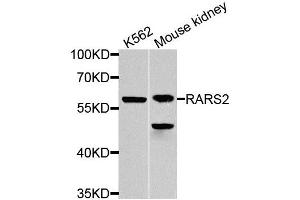 Western blot analysis of extracts of various cell lines, using RARS2 antibody (ABIN5974692) at 1/1000 dilution. (RARS2 antibody)