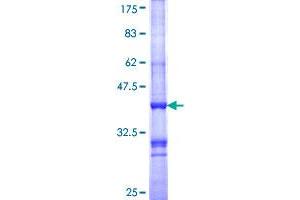 MC1 Receptor Protein (AA 1-100) (GST tag)