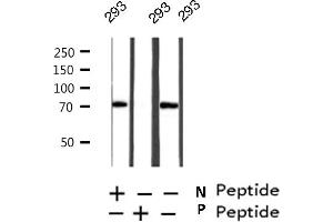Western blot analysis on 293 cell lysate using Phospho-RIPK2(Ser176) Antibody (RIPK2 antibody  (pSer176))