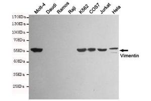 Western blot detection of Vimentin in Molt-4,K562,COS7,Jurkat,Hela and Vimentin negative cell (Daudi,Ramos,Raji) lysates using Vimentin mouse mAb (1:1000 diluted). (Vimentin antibody)