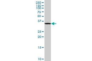 FN3K monoclonal antibody (M01), clone 4F2. (FN3K antibody  (AA 61-170))