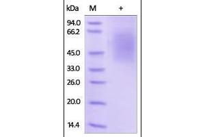 Human Fc epsilon RI alpha, His Tag on SDS-PAGE under reducing (R) condition. (Fc epsilon RI/FCER1A Protein (AA 26-205) (His tag))