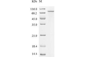 (Tris-Glycine gel) Discontinuous SDS-PAGE (reduced) with 5 % enrichment gel and 15 % separation gel.