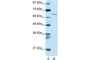 WB Suggested Anti-RFX5 Antibody Titration:  2. (RFX5 antibody  (N-Term))