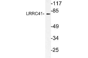 Western blot (WB) analysis of LRRC41 antibody in extracts from rat heart cells.