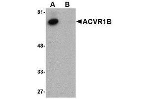 Western blot analysis of ACVR1B in human kidney tissue lysate with AP30015PU-N ACVR1B antibody at 1 μg/ml in (A) the absence and (B) the presence of blocking peptide.