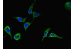 Immunofluorescent analysis of Hela cells using ABIN7145002 at dilution of 1:100 and Alexa Fluor 488-congugated AffiniPure Goat Anti-Rabbit IgG(H+L) (DHX33 antibody  (AA 116-357))