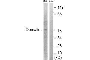 Immunohistochemistry analysis of paraffin-embedded human heart tissue using Dematin (Ab-403) antibody. (Dematin antibody  (Ser403))