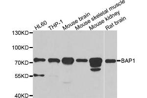 Western blot analysis of extracts of various cell lines, using BAP1 antibody (ABIN5973917) at 1/1000 dilution. (BAP1 antibody)