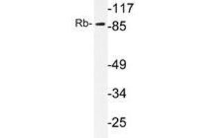 Western blot analysis of Rb antibody in extracts from HeLa cells. (Retinoblastoma 1 antibody)