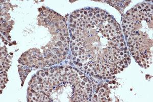Immunohistochemistry of paraffin-embedded mouse testis using HD Rabbit mAb (ABIN7267714) at dilution of 1:100 (40x lens). (HDAC8 antibody)