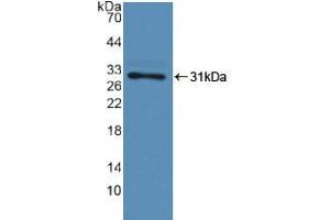 Western blot analysis of recombinant Human F13A1.